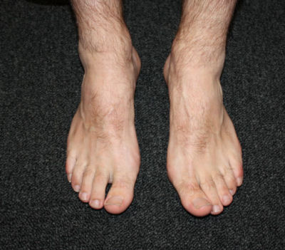 Adult's foot